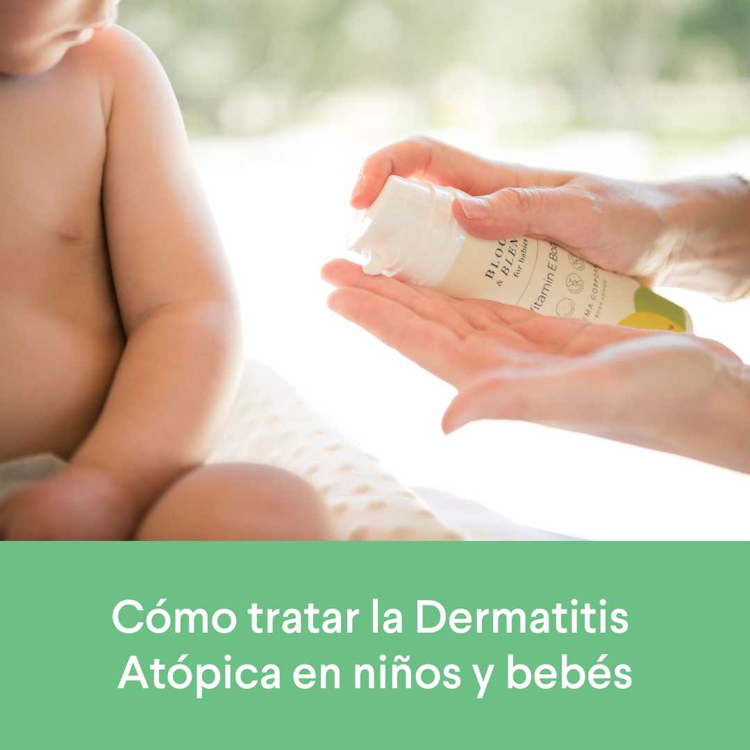 Cómo tratar la Dermatitis Atópica en niños y bebés